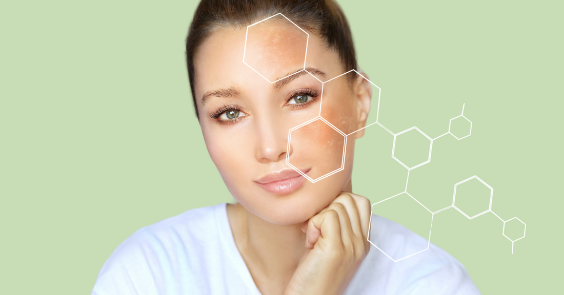 Sensitive Skin, Allergic Reactions & Skin Purging